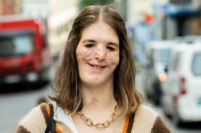 Emma Stadaas advarer om økende nettmobbing fra barn