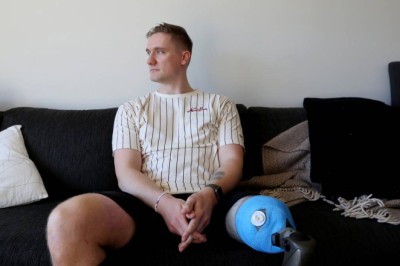 Mistet foten etter ulykken på elsparkesykkel: – Jeg skulle hatt forsikring