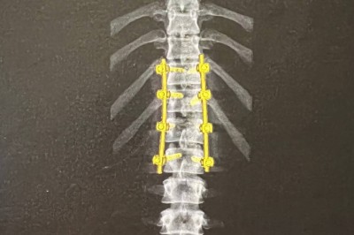 Iselin Bonsaksen Hagås blei avvist på Molde legevakt med knust ryggvirvel: Hadde ikkje ringt først