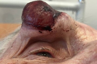 Gerd (100) blei sendt heim med blødande kul: – Ho har betalt sin del av skattepengane